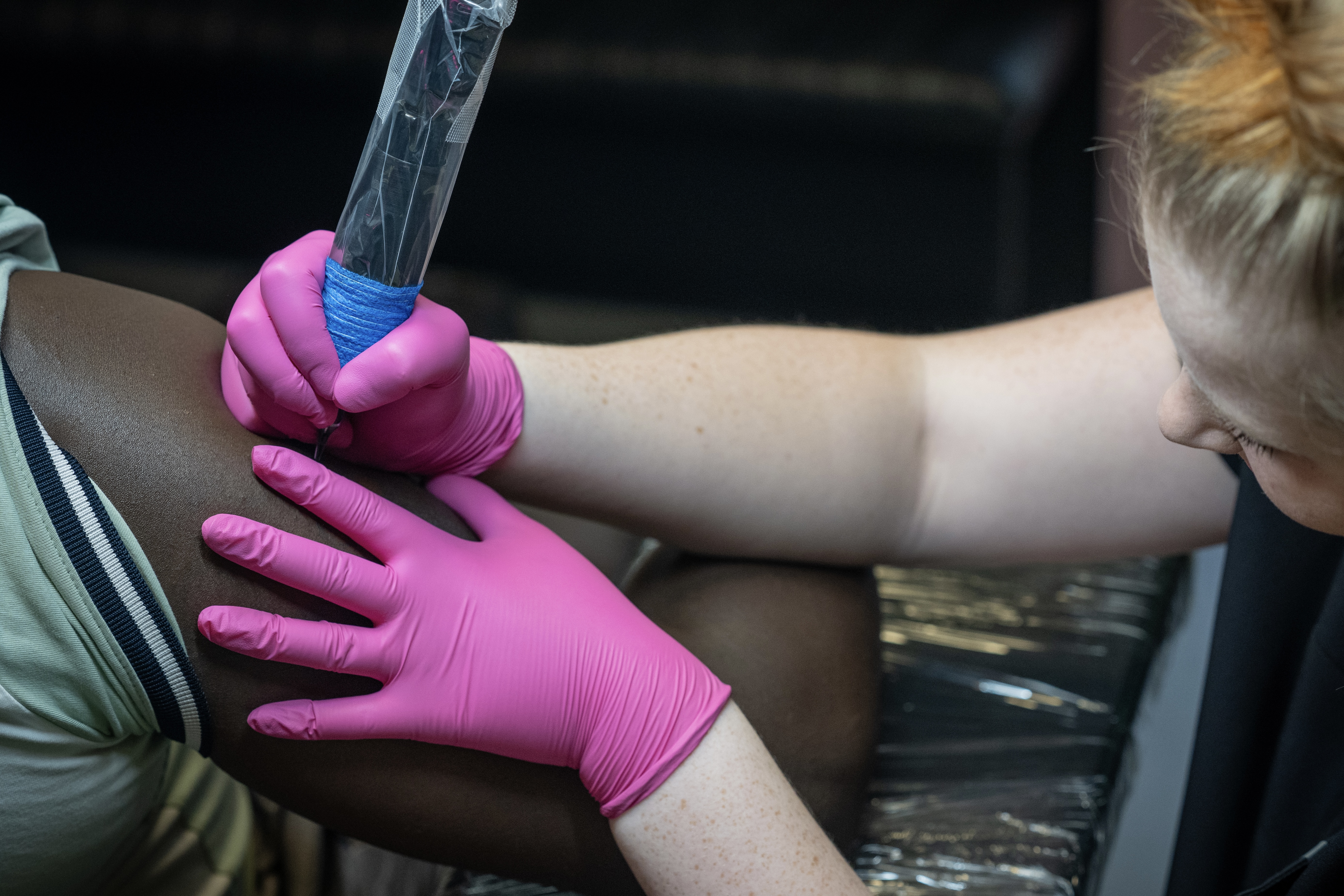 Inkless Scar Tattoo Treatment